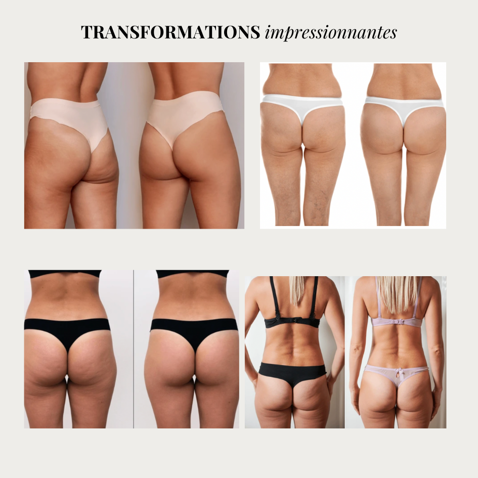 Linéa™ – Legging sculptant anti-cellulite
