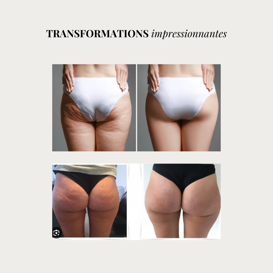 Linéa™ – Legging sculptant anti-cellulite