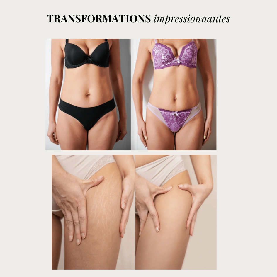 Linéa™ – Legging sculptant anti-cellulite
