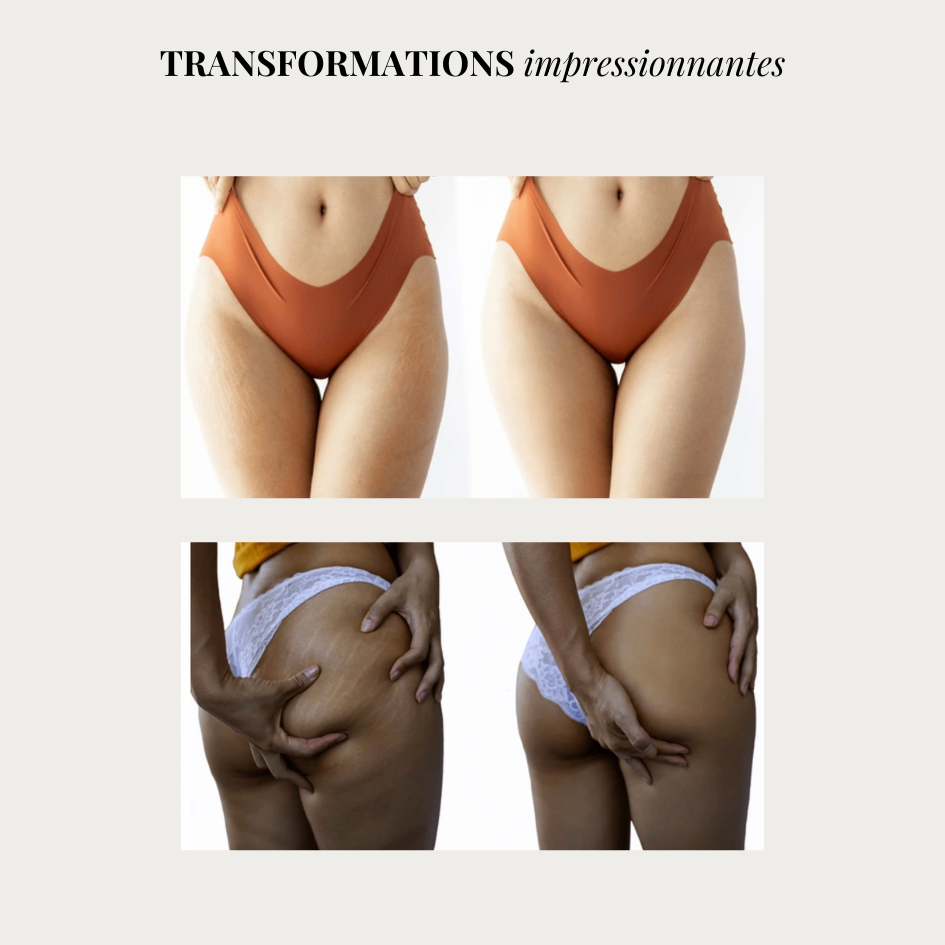 Linéa™ – Legging sculptant anti-cellulite