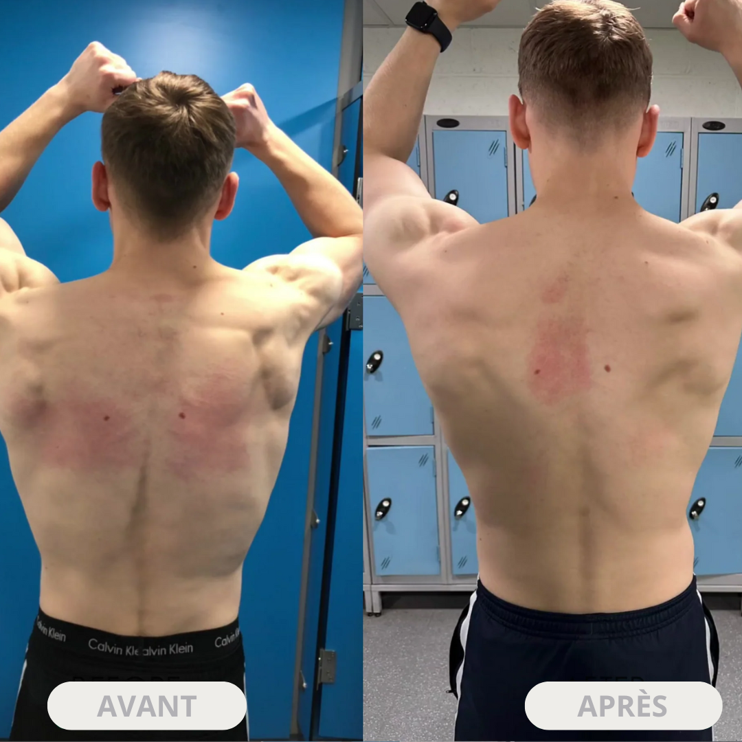 Aligna™ - Correcteur de posture instantané