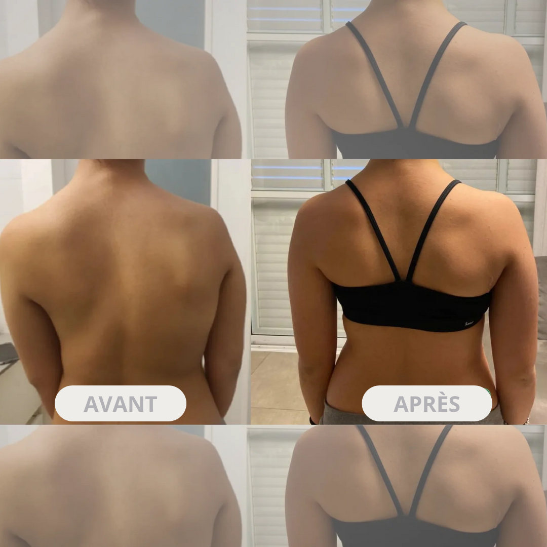 Aligna™ - Correcteur de posture instantané