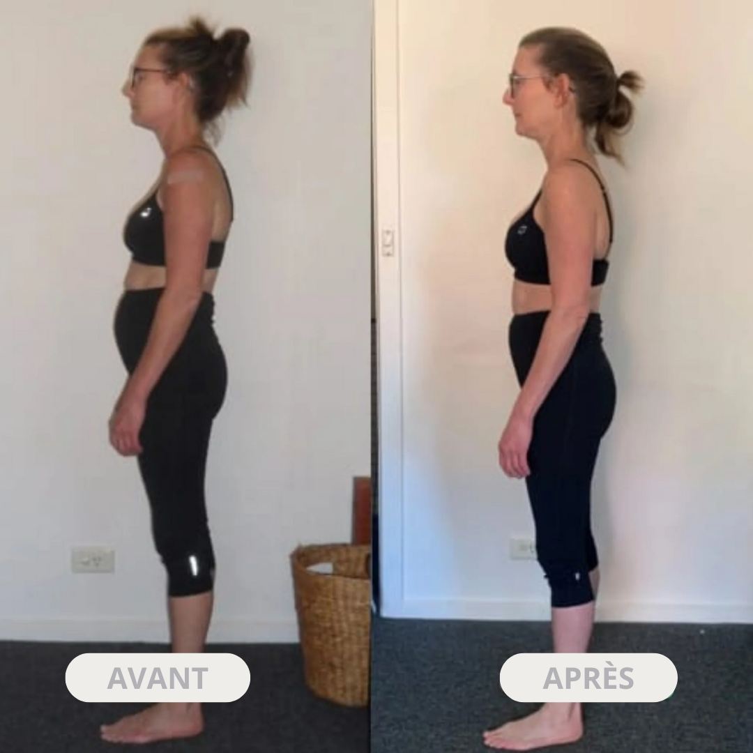 Aligna™ - Correcteur de posture instantané