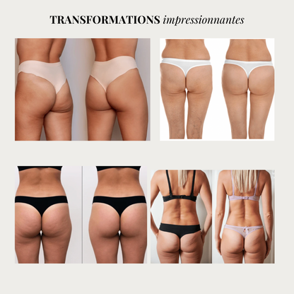 Linéa™ – Legging sculptant anti-cellulite